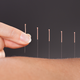 Image for article titled What's Wrong with Alternative Medicine?